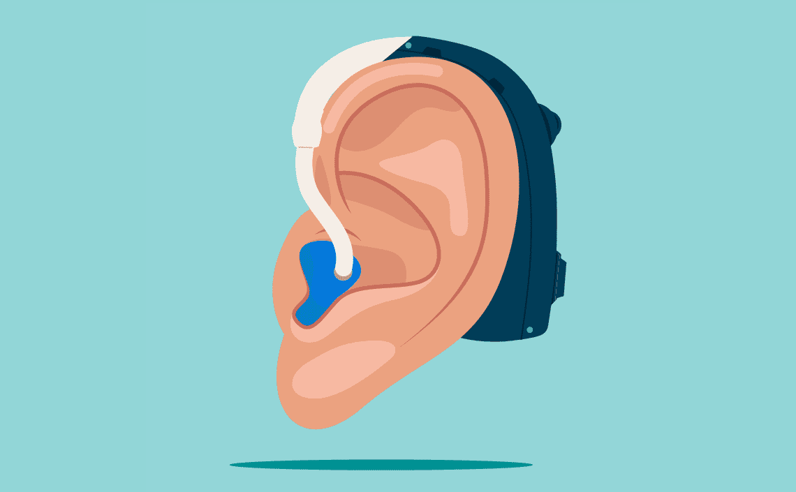 An illustration of an ear wearing a hearing aid