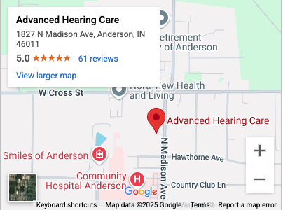A map of Anderson, Indiana location mobile